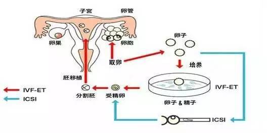 天津试管婴儿